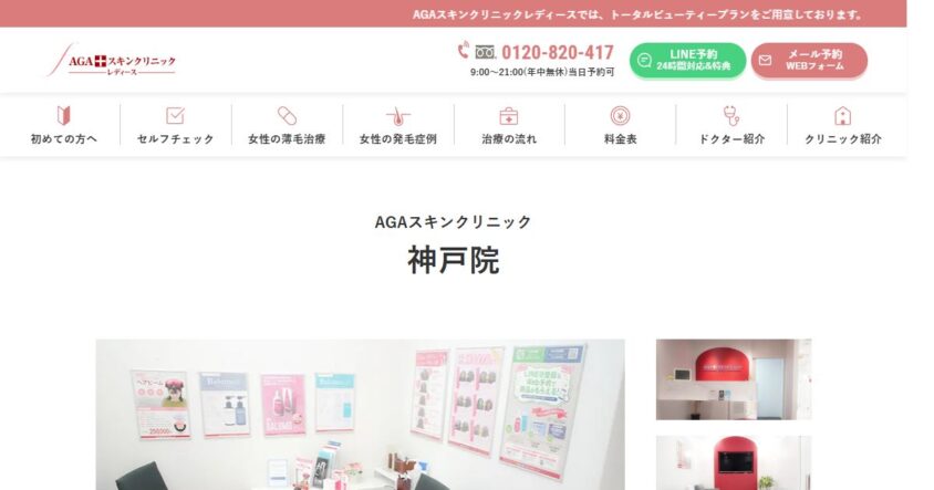 AGAスキンクリニック神戸院公式サイトのスクリーンショット